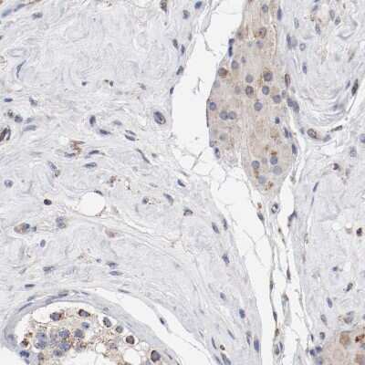 Immunohistochemistry-Paraffin: NDUFV2 Antibody [NBP1-84475]
