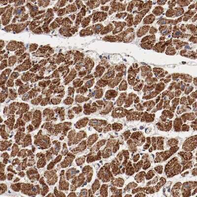 Immunohistochemistry-Paraffin: NDUFV2 Antibody [NBP1-84475]