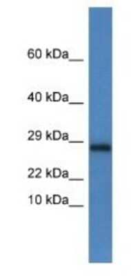 Western Blot: NDUFV2 Antibody [NBP1-79680]