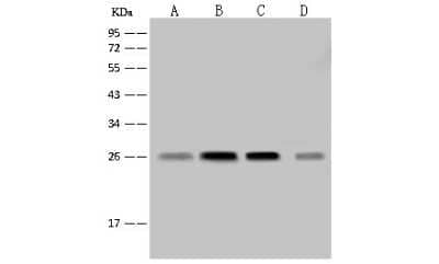 Western Blot: NDUFV2 Antibody [NBP2-99225]