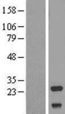 Western Blot: NDUFV2 Overexpression Lysate [NBL1-13567]