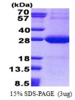 SDS-PAGE: Recombinant Human NDUFV2 His Protein [NBP2-23268]