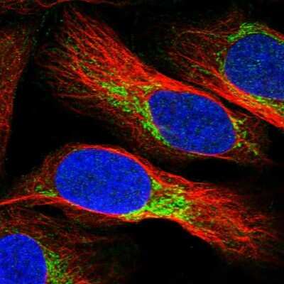 Immunocytochemistry/ Immunofluorescence: NDUFV3 Antibody [NBP1-85621]