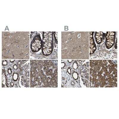 Immunohistochemistry-Paraffin: NDUFV3 Antibody [NBP1-85622]