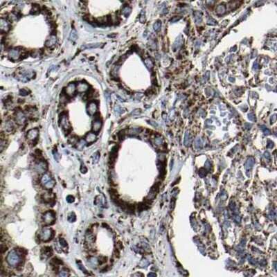 Immunohistochemistry-Paraffin: NDUFV3 Antibody [NBP1-85622]