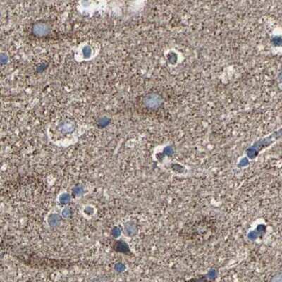 Immunohistochemistry-Paraffin: NDUFV3 Antibody [NBP1-85622]