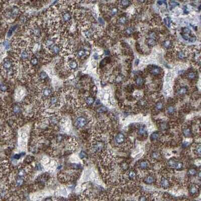 Immunohistochemistry-Paraffin: NDUFV3 Antibody [NBP1-85622]