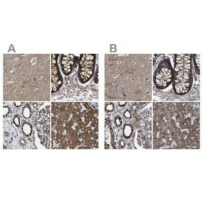 Immunohistochemistry-Paraffin: NDUFV3 Antibody [NBP1-85623]