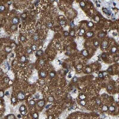 Immunohistochemistry-Paraffin: NDUFV3 Antibody [NBP1-85623]