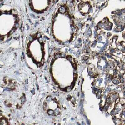 Immunohistochemistry-Paraffin: NDUFV3 Antibody [NBP1-85623]