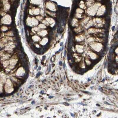 Immunohistochemistry-Paraffin: NDUFV3 Antibody [NBP1-85623]