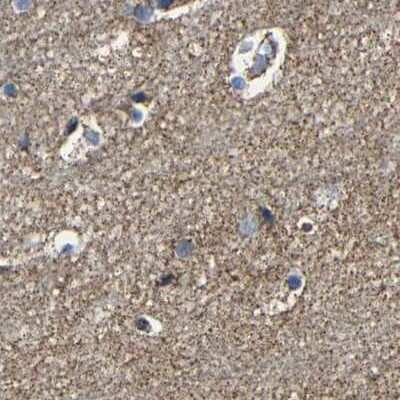 Immunohistochemistry-Paraffin: NDUFV3 Antibody [NBP1-85623]