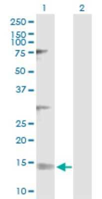 Western Blot: NDUFV3 Antibody [H00004731-D01P]