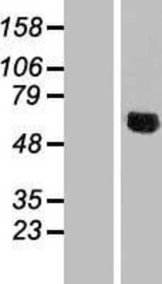 Western Blot: NDUFV3 Overexpression Lysate [NBL1-13568]