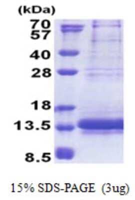 SDS-PAGE: Recombinant Human NDUFV3 His Protein [NBP2-23269]