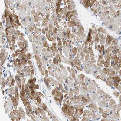 Immunohistochemistry: NEBL Antibody [NBP1-86462]