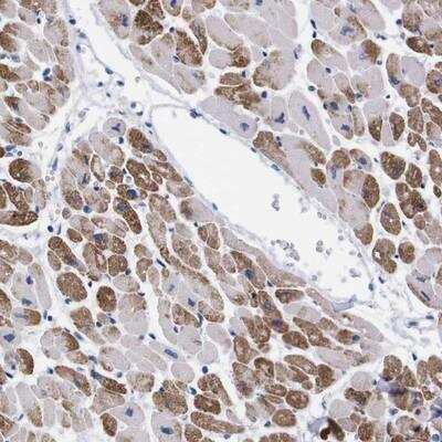 Immunohistochemistry-Paraffin: NEBL Antibody [NBP1-86463]