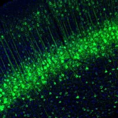Immunohistochemistry: NECAB1 Antibody [NBP1-84004]