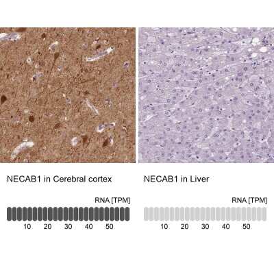 Immunohistochemistry-Paraffin: NECAB1 Antibody [NBP1-84003]