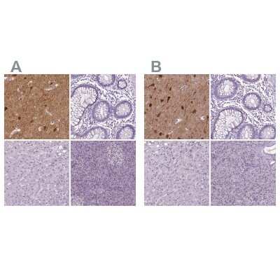 Immunohistochemistry-Paraffin: NECAB1 Antibody [NBP1-84003]