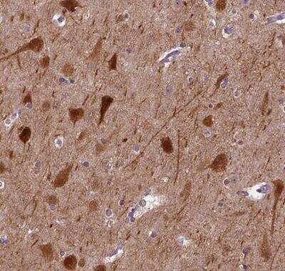 Immunohistochemistry-Paraffin: NECAB1 Antibody [NBP1-84004]
