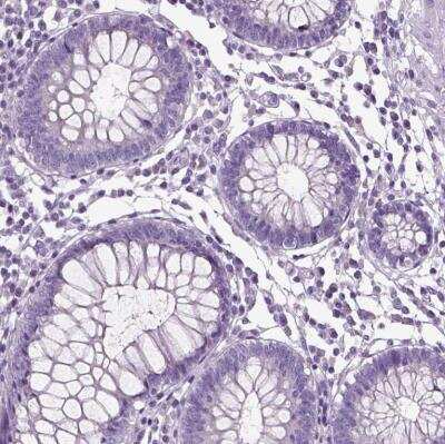 Immunohistochemistry-Paraffin: NECAB1 Antibody [NBP1-84004]