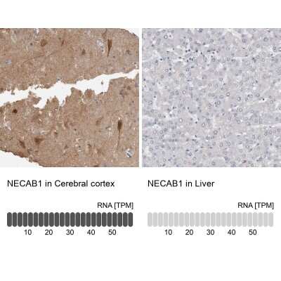 Immunohistochemistry-Paraffin: NECAB1 Antibody [NBP1-84005]