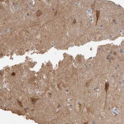 Immunohistochemistry-Paraffin: NECAB1 Antibody [NBP1-84005]