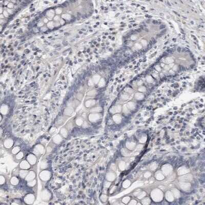 Immunohistochemistry-Paraffin: NECAB1 Antibody [NBP1-84005]