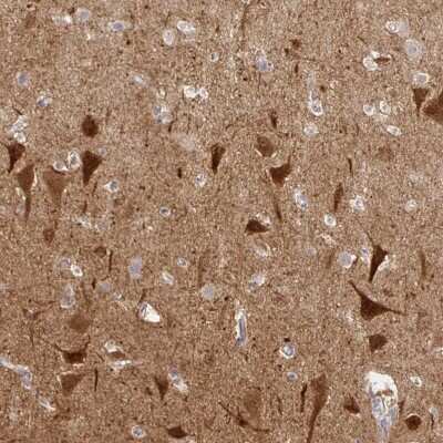Immunohistochemistry-Paraffin: NECAB1 Antibody [NBP2-33949]