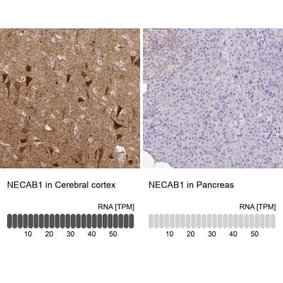 Immunohistochemistry-Paraffin: NECAB1 Antibody [NBP2-33949]