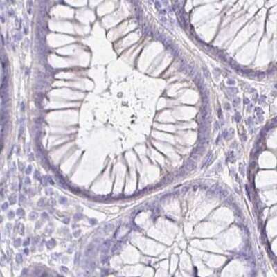 Immunohistochemistry-Paraffin: NECAB1 Antibody [NBP2-33949]