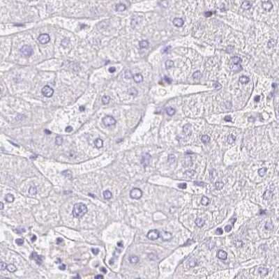 Immunohistochemistry-Paraffin: NECAB1 Antibody [NBP2-33949]
