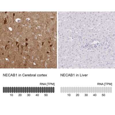 Immunohistochemistry-Paraffin: NECAB1 Antibody [NBP2-33949]