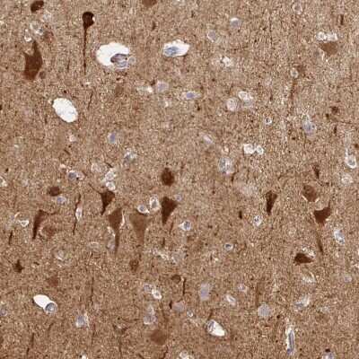 Immunohistochemistry-Paraffin: NECAB1 Antibody [NBP2-33949]