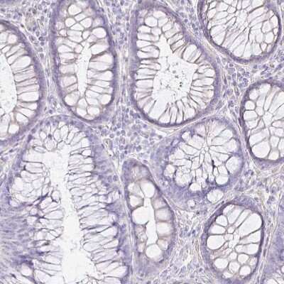Immunohistochemistry-Paraffin: NECAB1 Antibody [NBP2-33949]
