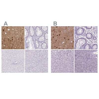 Immunohistochemistry-Paraffin: NECAB1 Antibody [NBP2-33949]