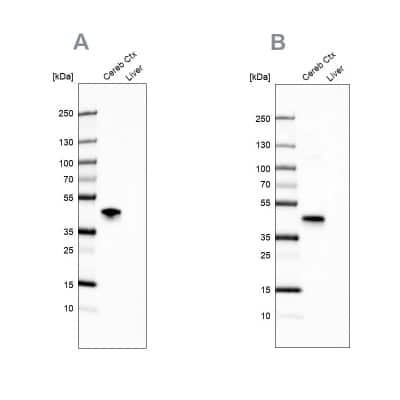 Western Blot: NECAB1 Antibody [NBP2-33949]