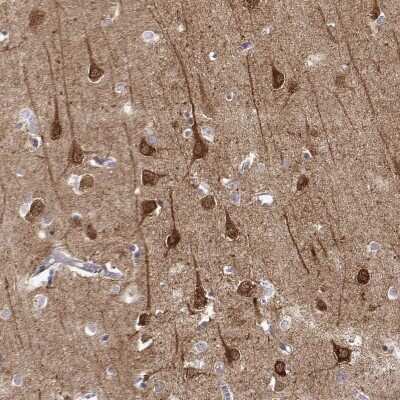 Immunohistochemistry: NECAB3 Antibody [NBP2-68902]