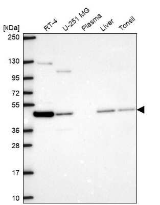 Western Blot: NECAB3 Antibody [NBP2-68925]