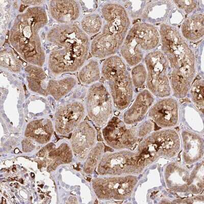 Immunohistochemistry: NECAP1 Antibody [NBP2-38022]