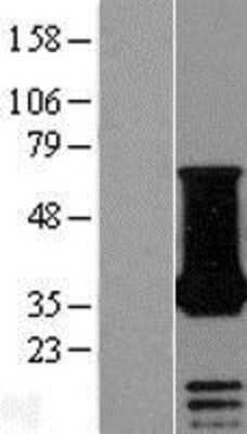 Western Blot: NECAP1 Overexpression Lysate [NBL1-13571]