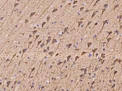 Immunohistochemistry-Paraffin: NECAP2 Antibody [NBP2-97285]