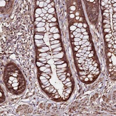 Immunohistochemistry-Paraffin: NEDD1 Antibody [NBP1-83377]