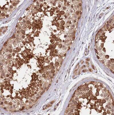 Immunohistochemistry-Paraffin: NEDD1 Antibody [NBP1-83377]