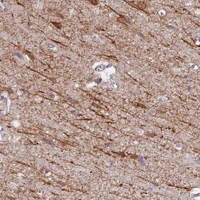 Immunohistochemistry-Paraffin: NEDD4 Antibody [NBP1-83044]