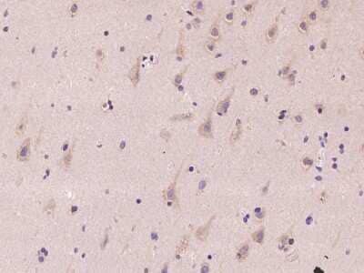 Immunohistochemistry-Paraffin: NEDD4 Antibody [NBP2-97422]