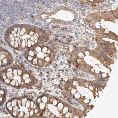 Immunohistochemistry-Paraffin: NEDD4L Antibody [NBP1-81508]