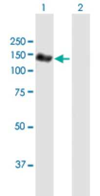 Western Blot: NEDD4L Antibody [H00023327-B01P]