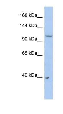 Western Blot: NEDD4L Antibody [NBP1-54974]